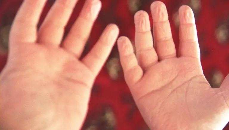 Close-up of wrinkled fingers | Why Your Fingers Wrinkle in Water