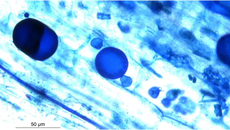 mycorrhizae microscope | How Trees Communicate